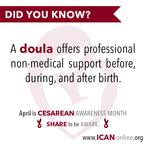 Doulas offer professional Cesarean Support